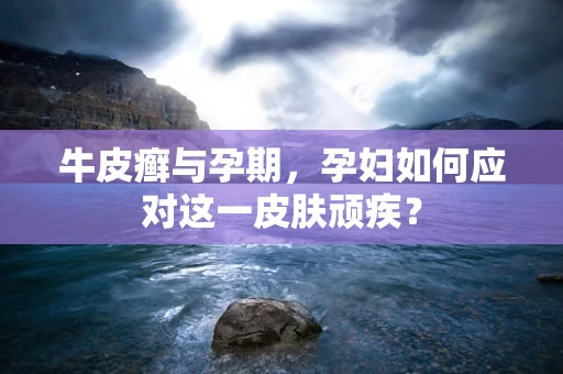牛皮癣与孕期，孕妇如何应对这一皮肤顽疾？